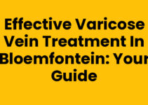 Effective Varicose Vein Treatment in Bloemfontein: Your Guide Effective Varicose Vein Treatment in Bloemfontein: Your Guide