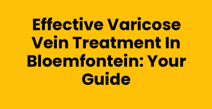 Effective Varicose Vein Treatment in Bloemfontein: Your Guide